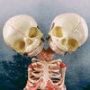 Fetal Conjoined Twins Anatomical Model